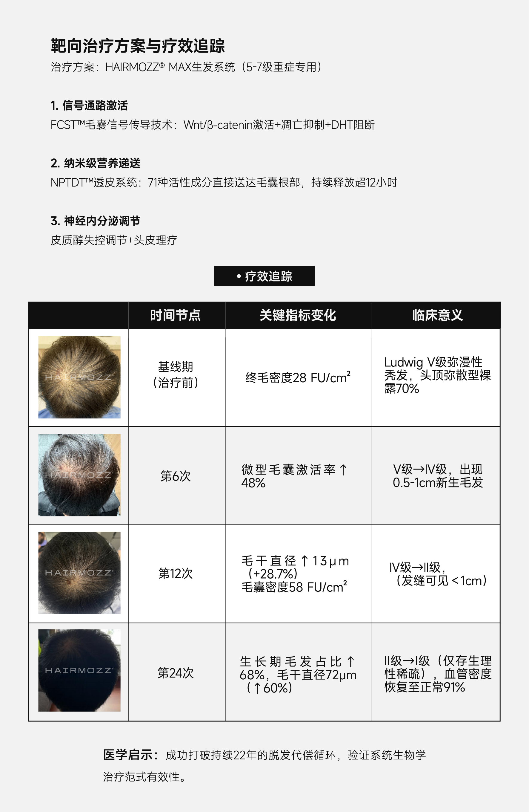 HAIRMOZZ生发案例