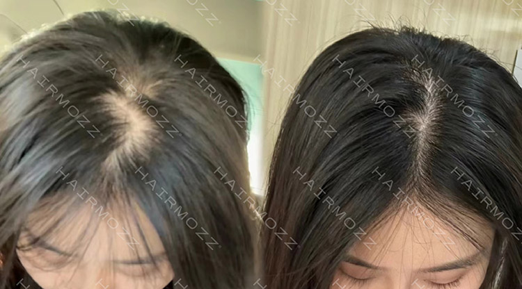 生发对比图-03.jpg