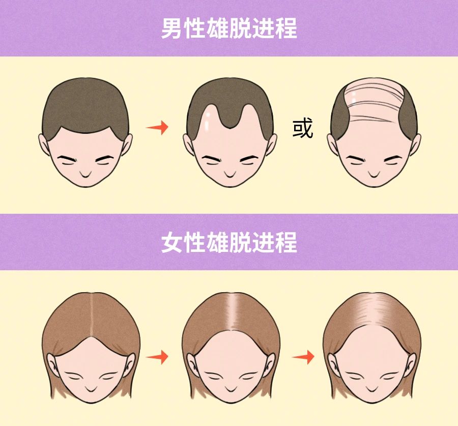 雄脱.jpg