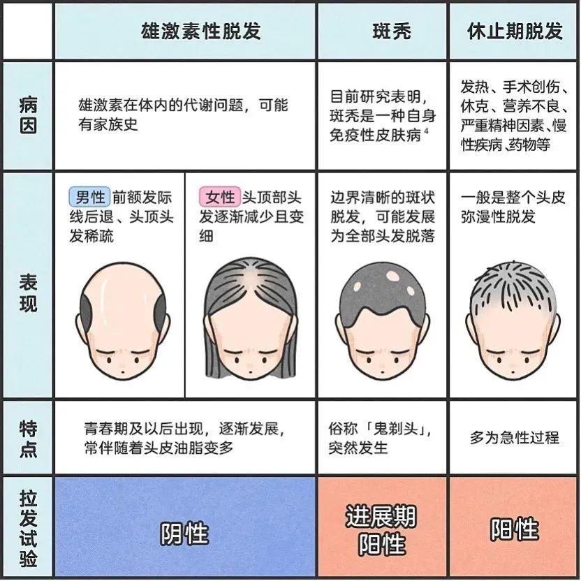 脱发类型.jpg